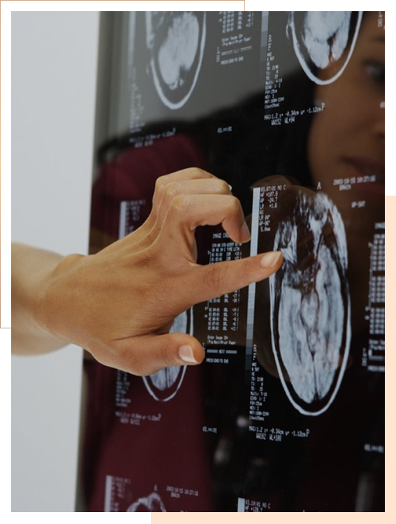 A hand points at a brain scan image displayed on a screen, with medical data and various brain scan images visible.